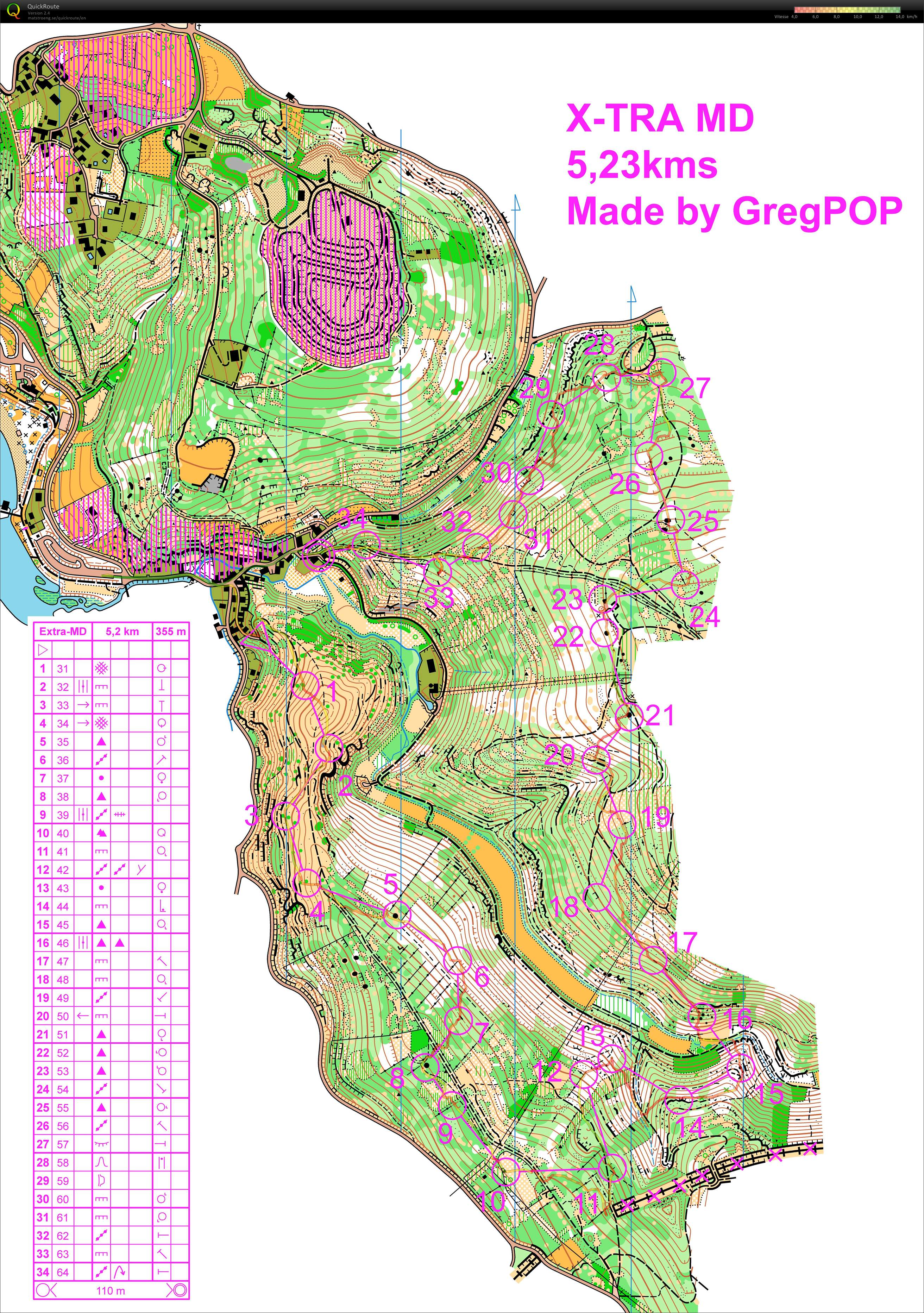 Extra-MD (12/05/2014)